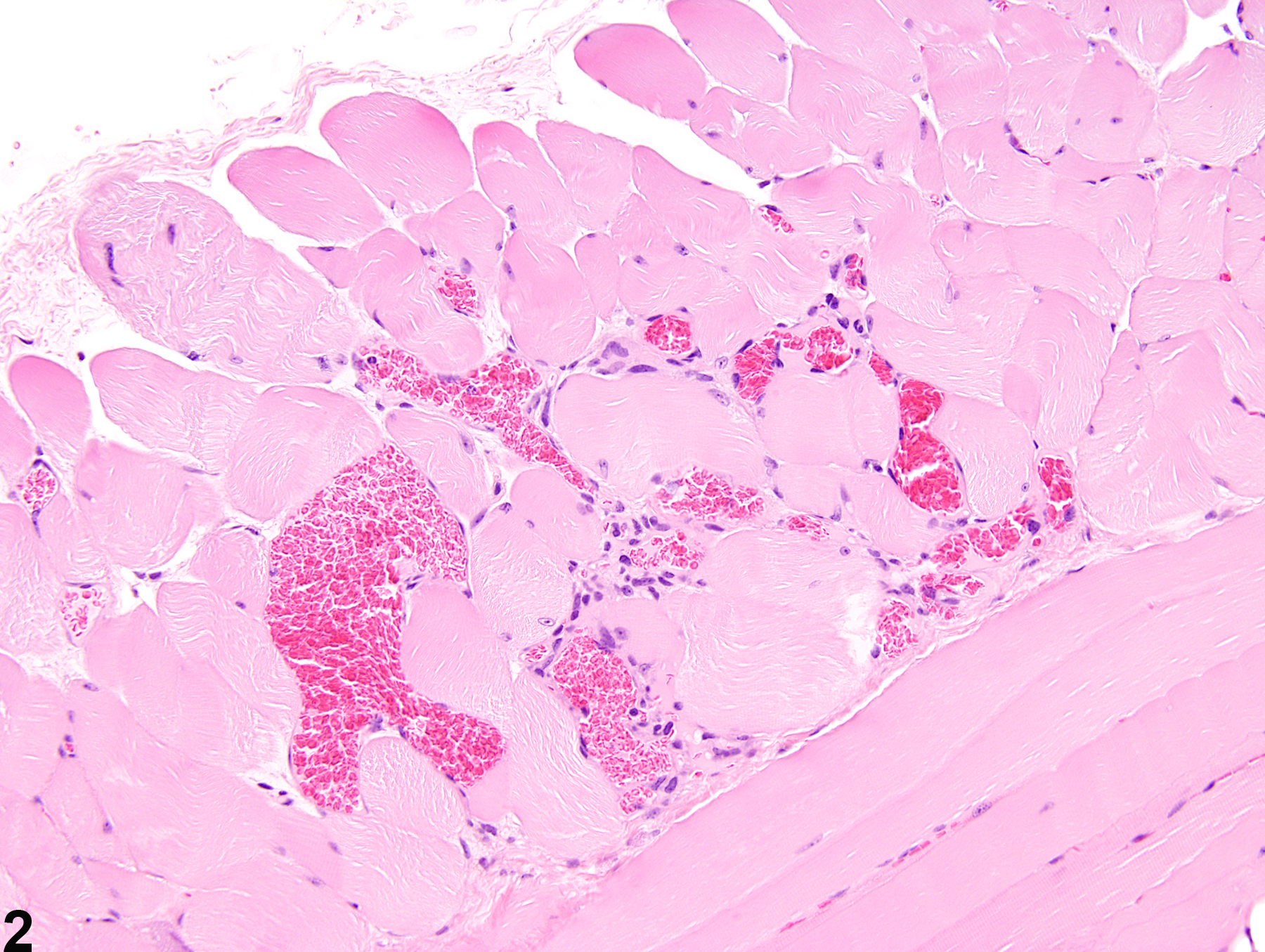 Image of angiectasis in the skeletal muscle from a male B6C3F1/N mouse in a chronic study