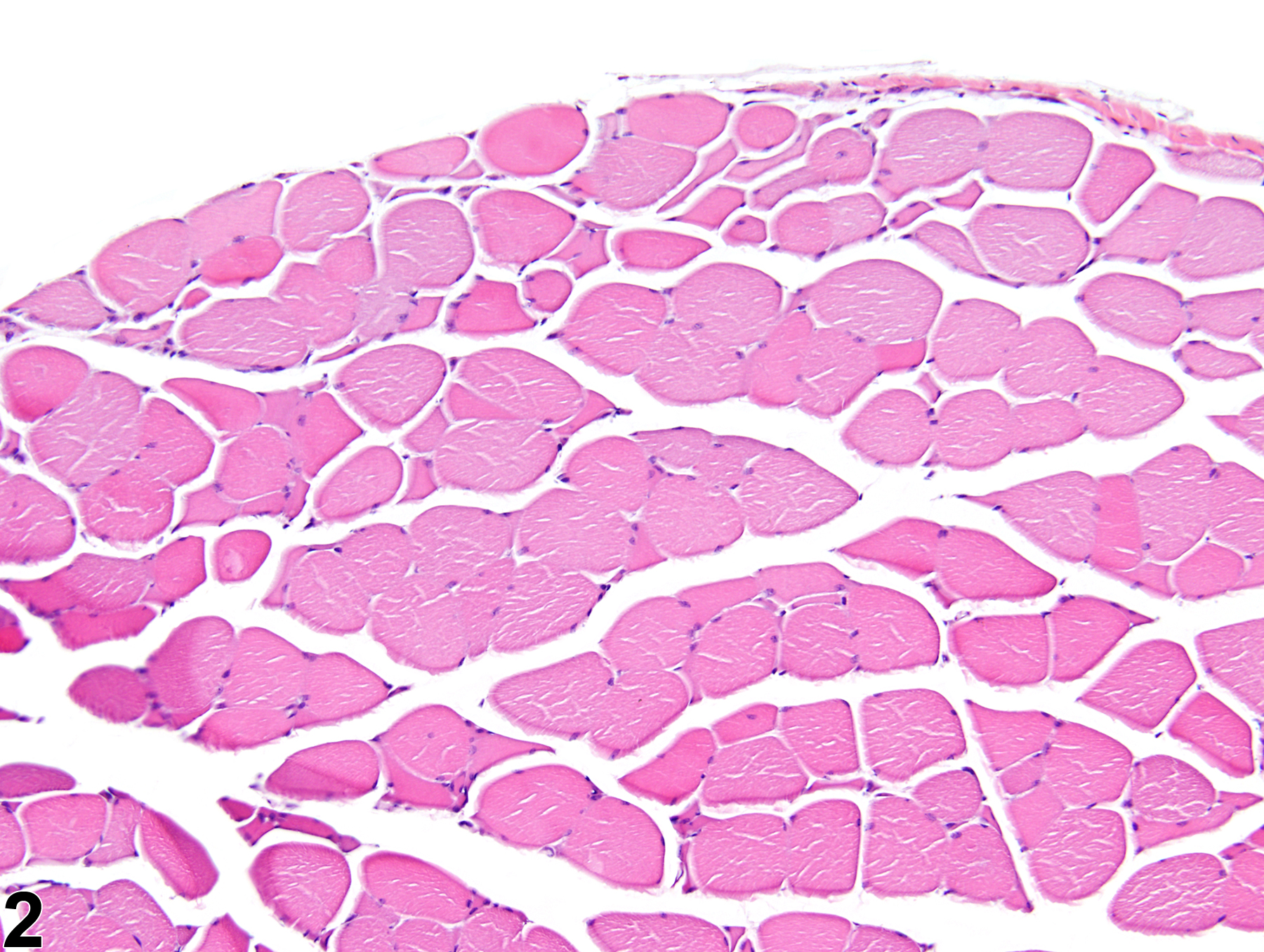 Image of atrophy in the skeletal muscle from a male B6C3F1/N mouse in a subchronic study