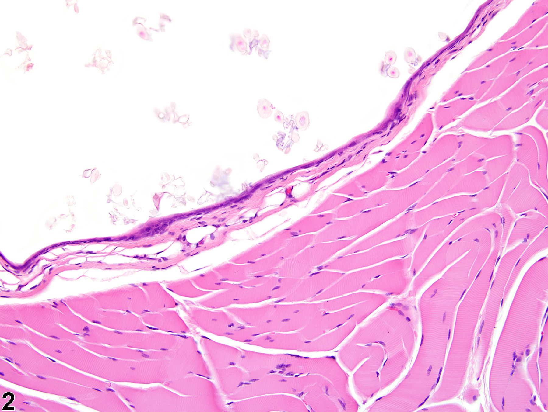 Image of cyst in the skeletal muscle from a female F344/N rat in a chronic study