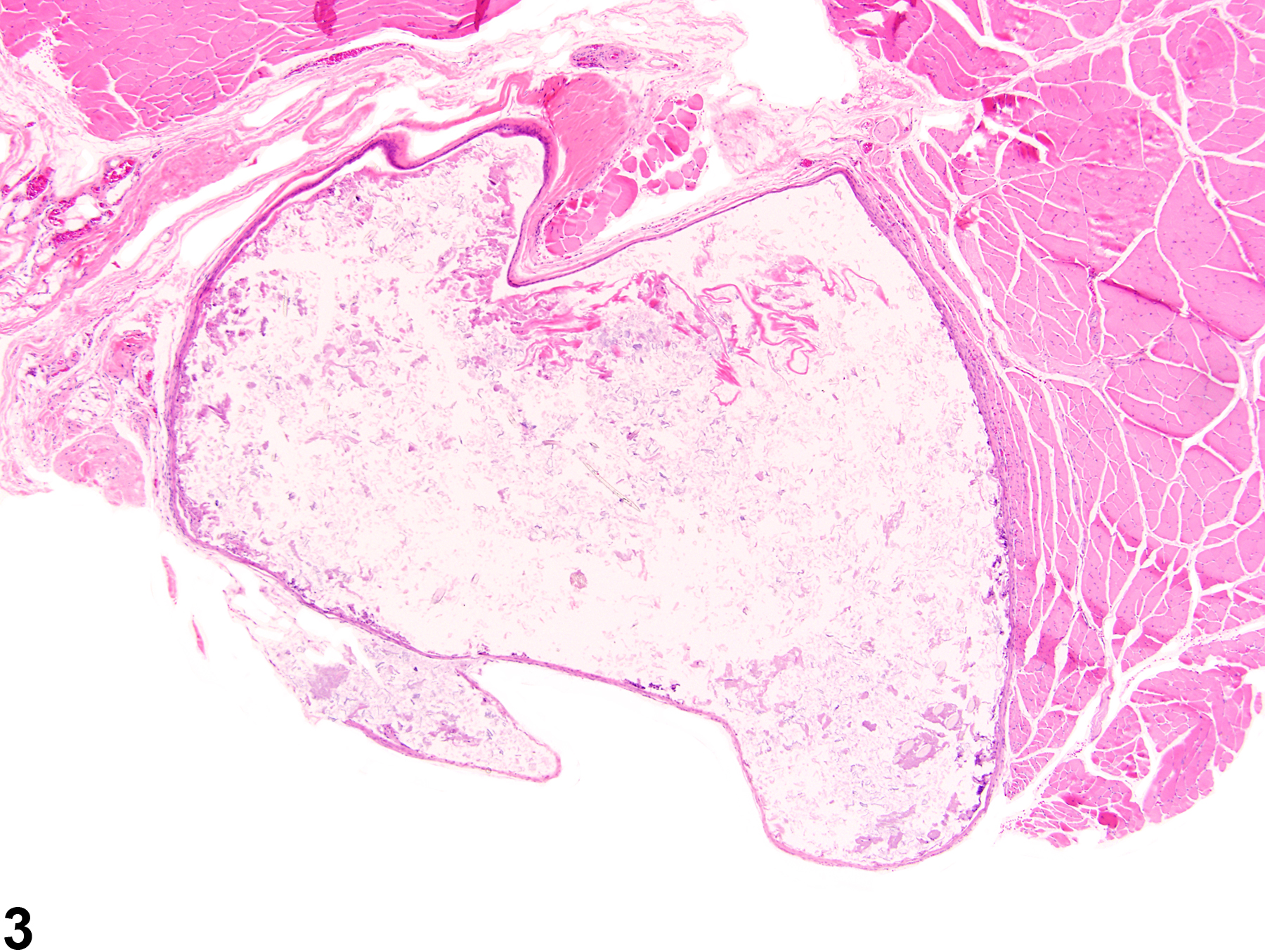 Image of cyst in the skeletal muscle from a female F344/N rat in a chronic study