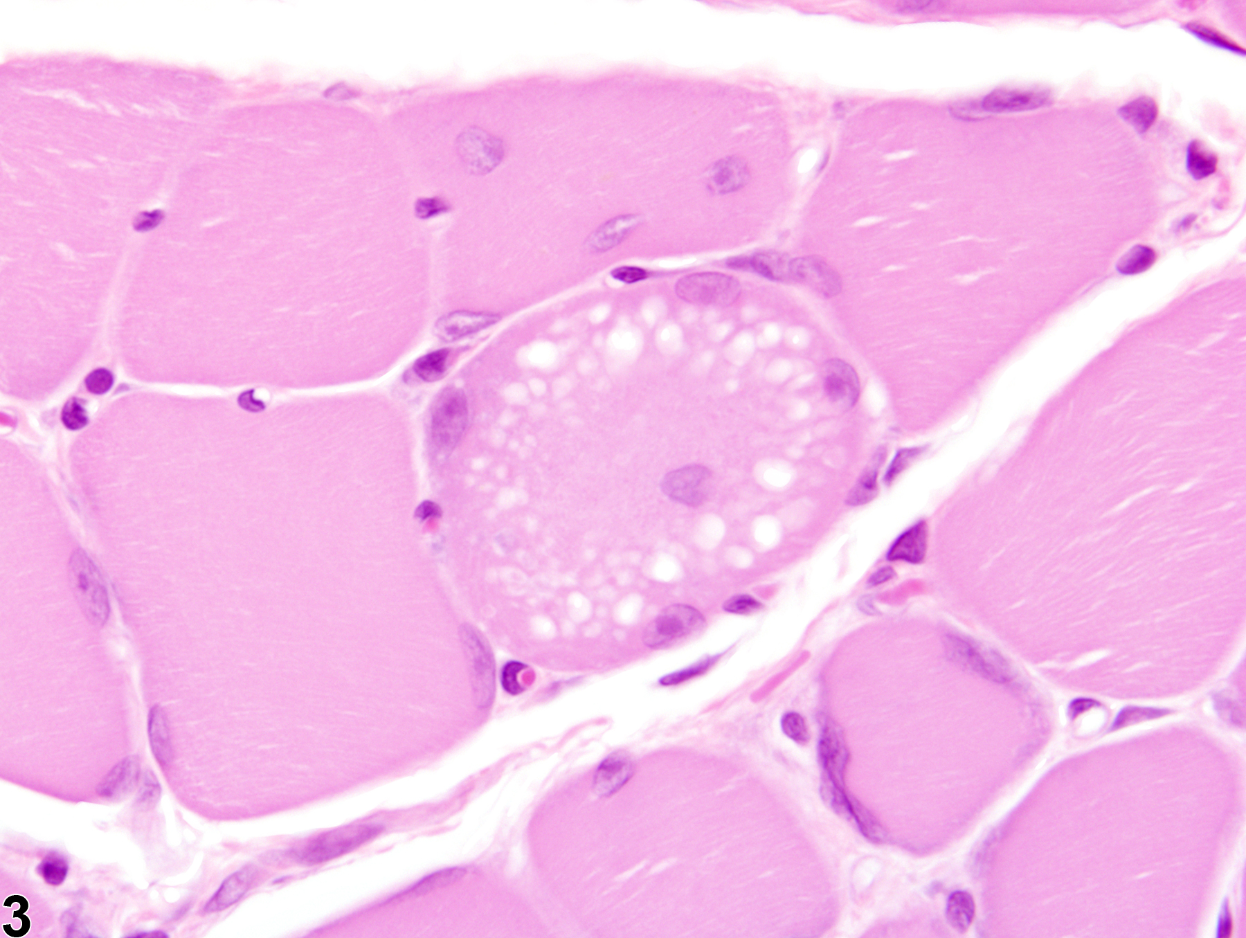 Image of degeneration in the skeletal muscle from a male Harlan Sprague-Dawley rat in a subchronic study