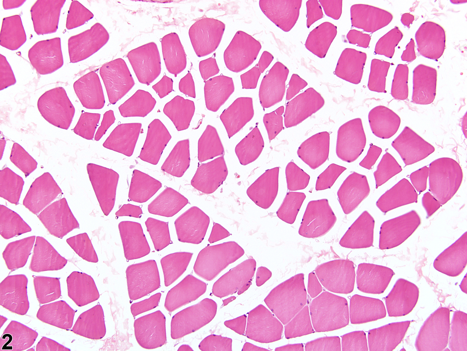 Image of edema in the skeletal muscle from a male F344/N rat in a chronic study