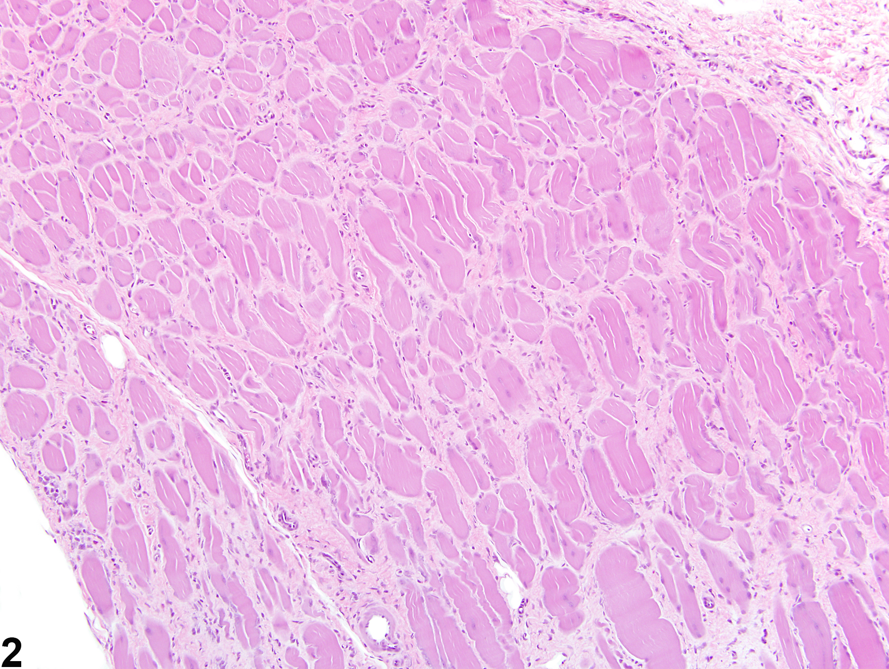 Image of fibrosis in the skeletal muscle from a male Harlan Sprague-Dawley rat in a subchronic study
