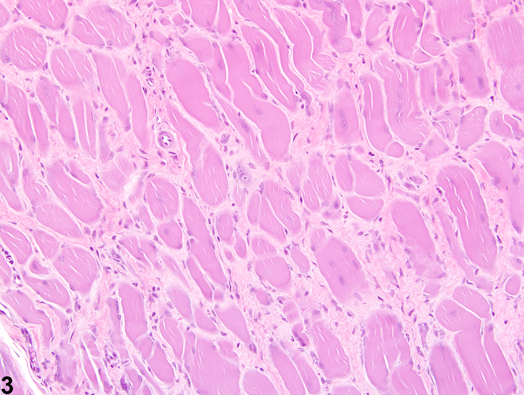 Image of fibrosis in the skeletal muscle from a male Harlan Sprague-Dawley rat in a subchronic study