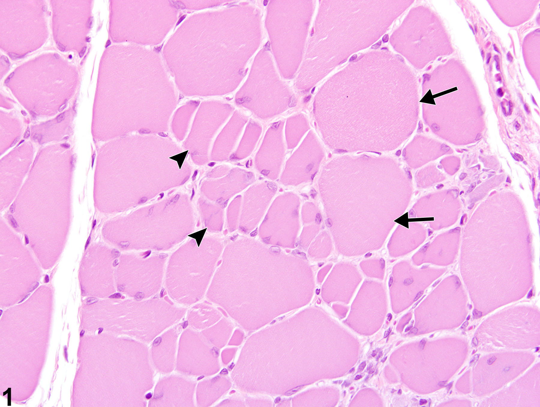 Image of hypertrophy in the skeletal muscle from a male Harlan Sprague-Dawley rat in a subchronic study