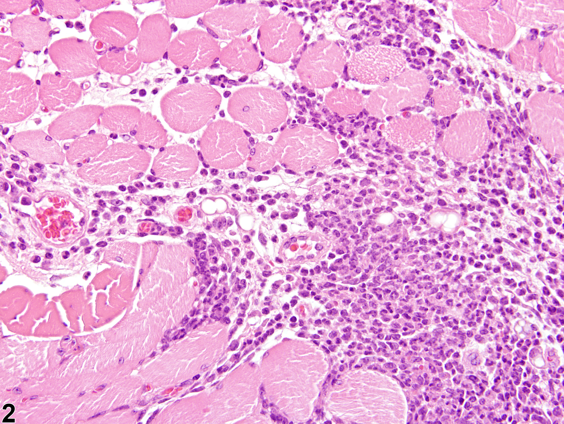 Image of inflammation in the skeletal muscle from a female Swiss CD-1 mouse in a chronic study