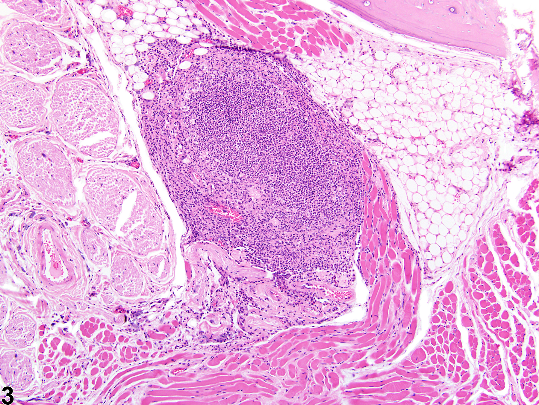 Image of inflammation in the skeletal muscle from a male B6C3F1/N mouse in a chronic study