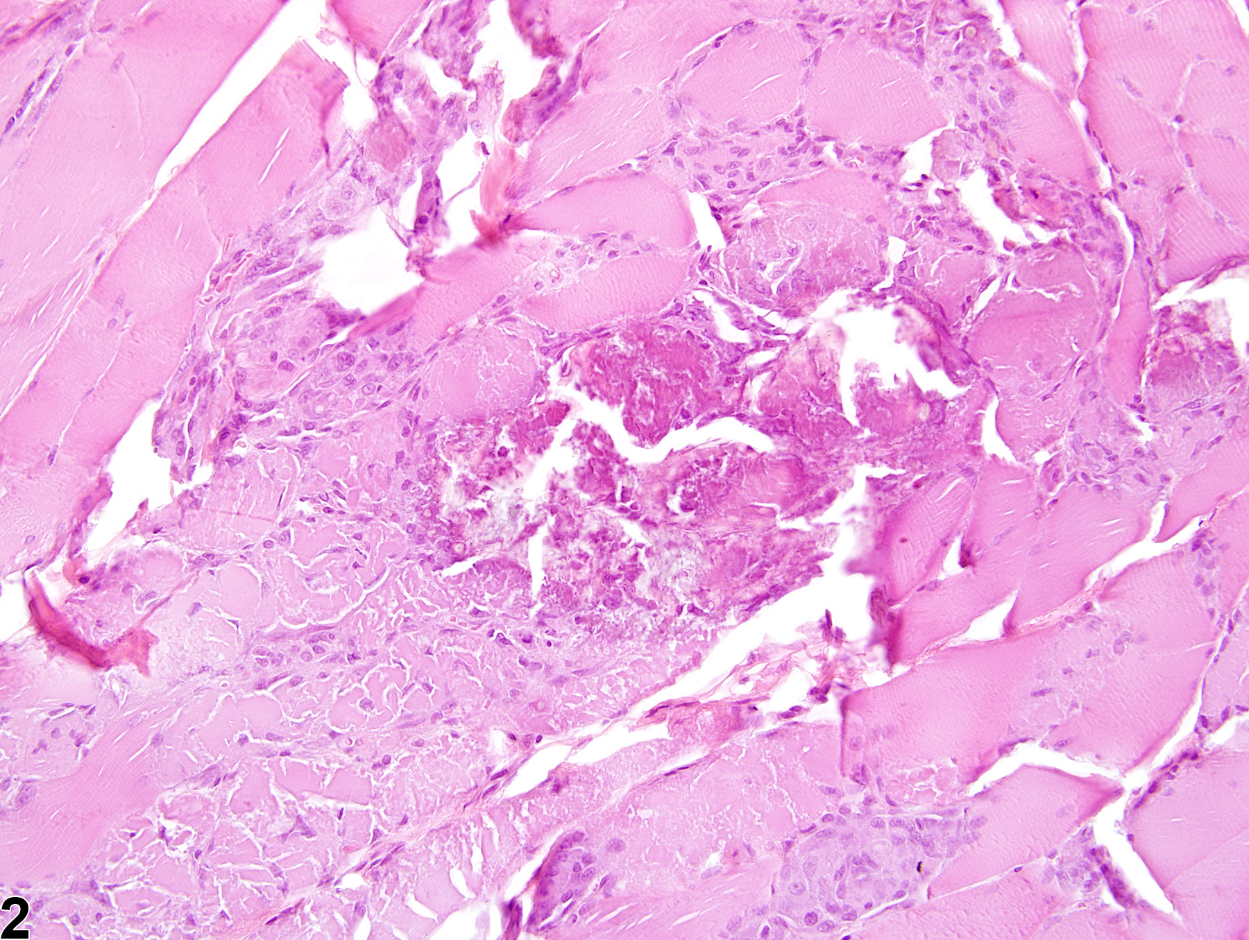 Image of necrosis in the skeletal muscle from a male F344/N rat in a chronic study
