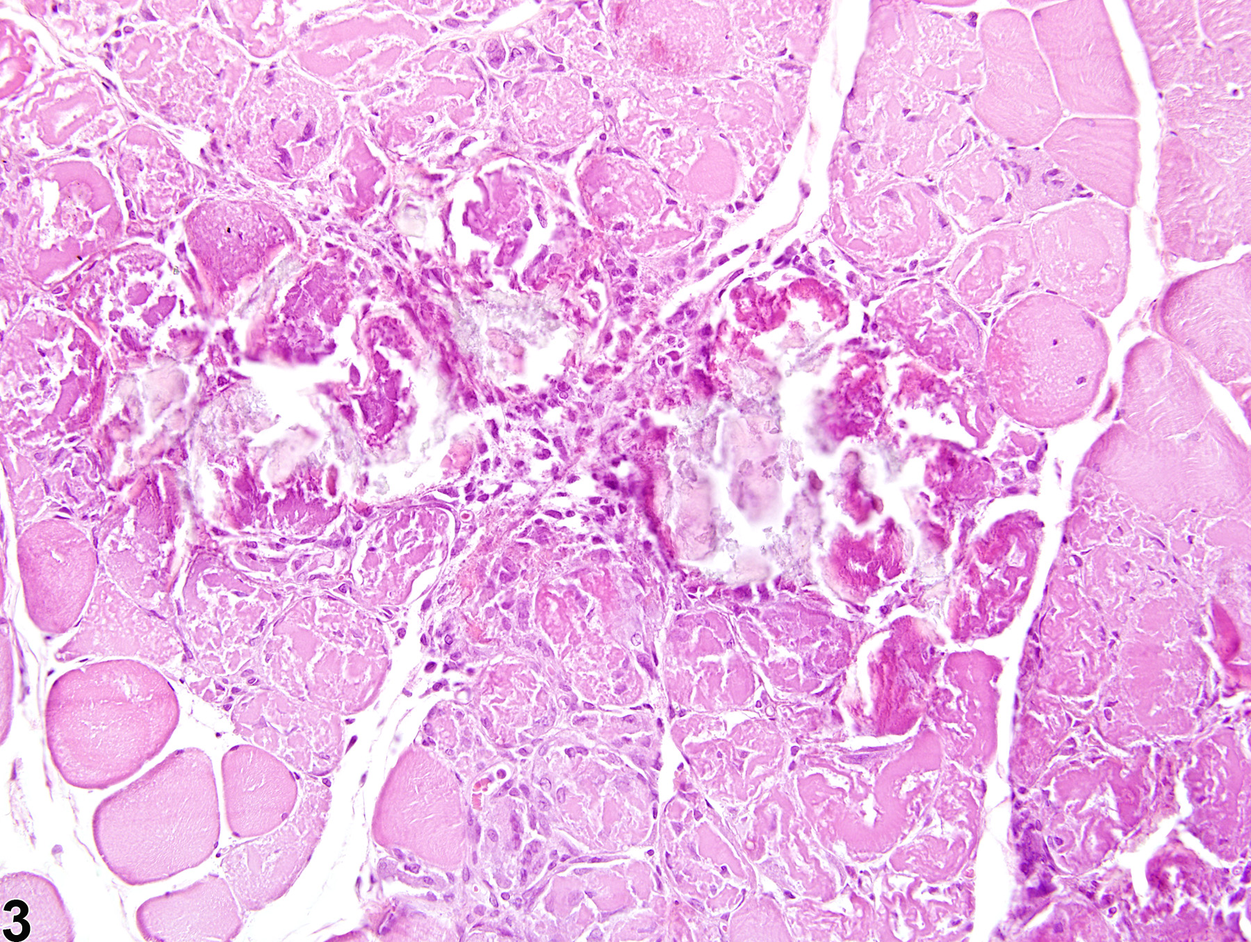 Image of necrosis in the skeletal muscle from a male F344/N rat in a chronic study