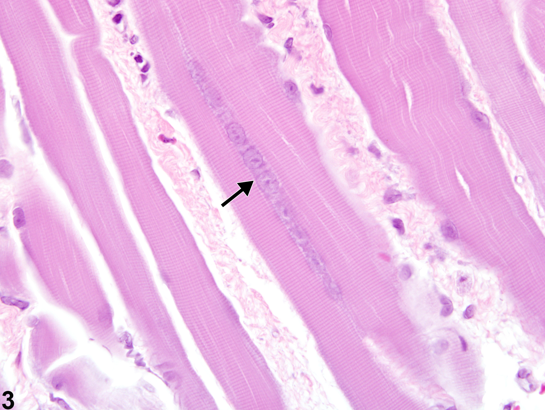 Image of regeneration in the skeletal muscle from a male Harlan Sprague-Dawley rat in a subchronic study