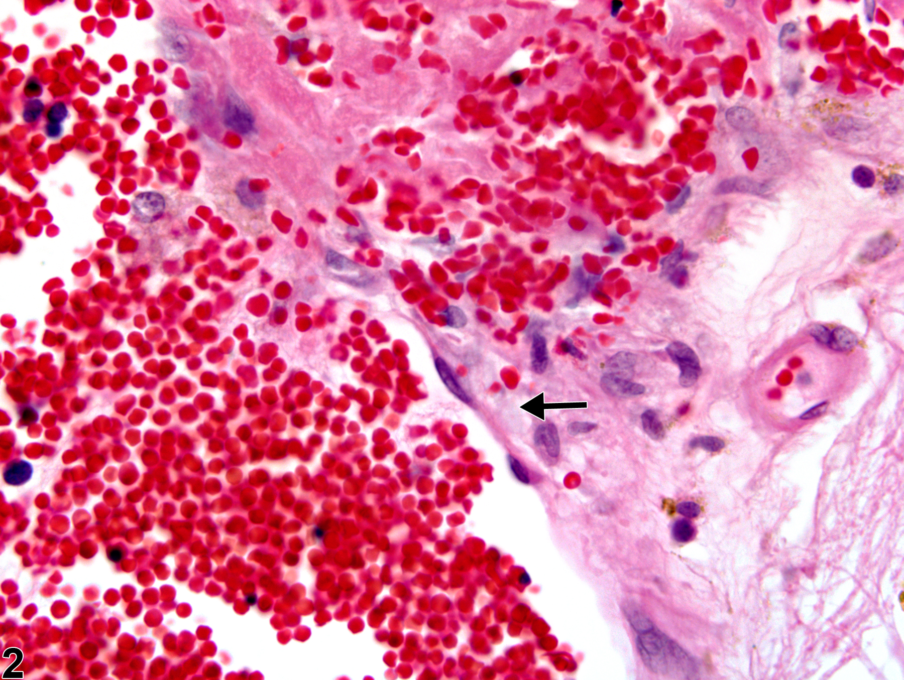 Image of angiectasis in the brain from a female F344/N rat in a chronic study