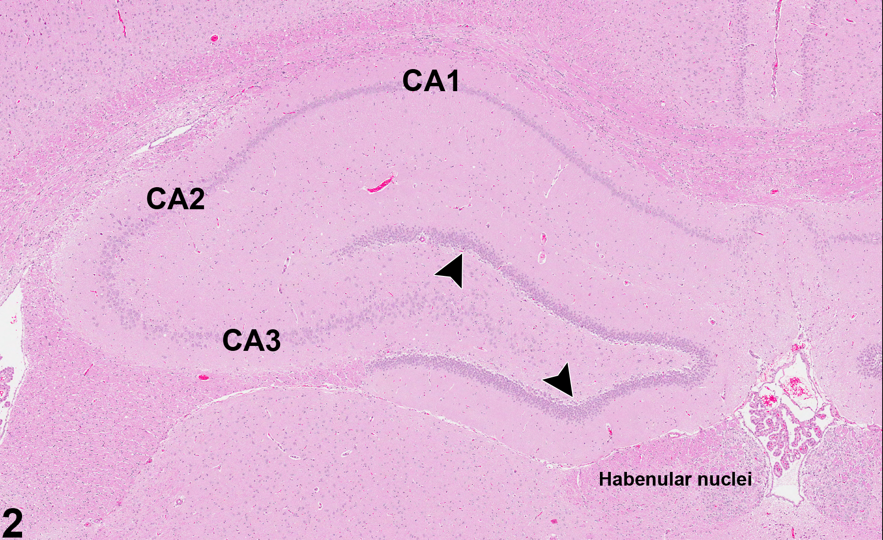 Image of dysplasia (normal comparison) in the brain from a rat