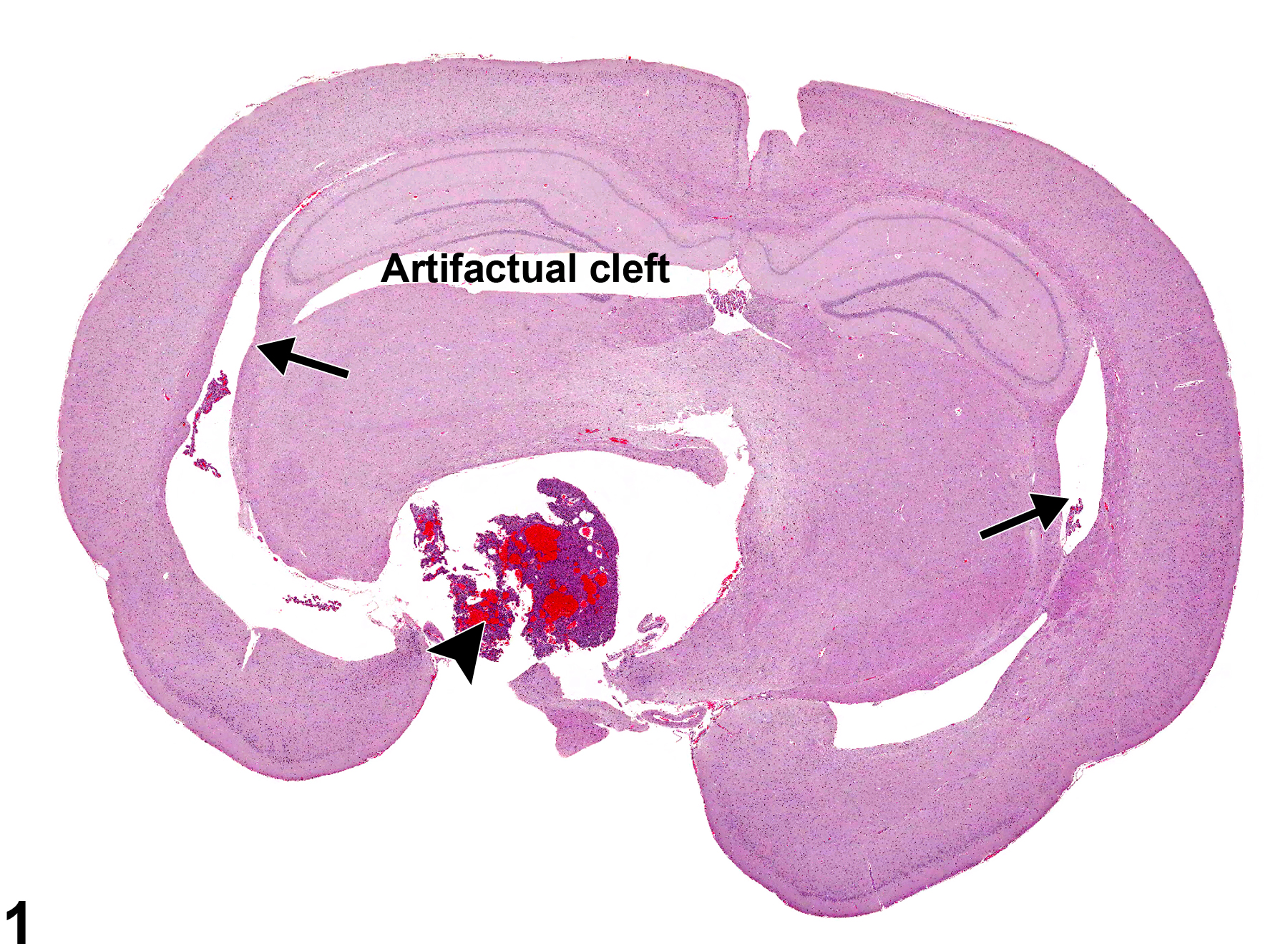 Image of hydrocephalus in the brain from a male F344/N rat in a chronic study