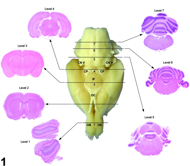 Image of Seven transverse (coronal sections) in the Brain from a Rat