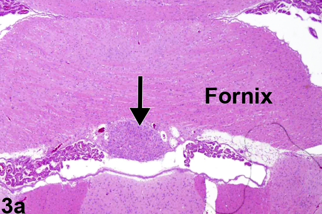 Image of normal circumventricular subfornical organ in the brain from a male Harlan Sprague-Dawley rat in a 6-month study