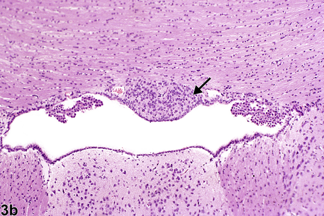 Image of normal circumventricular subfornical organ in the brain from a male B6C3F1 mouse
