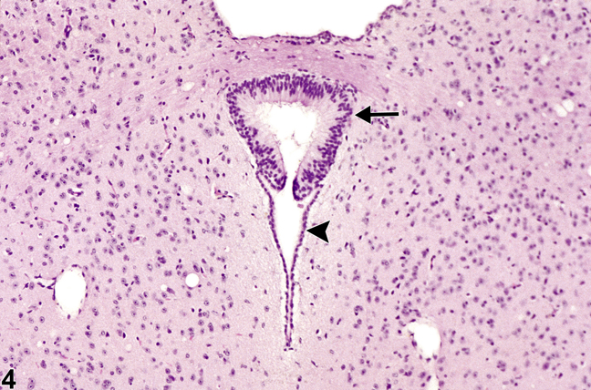 Image of normal circumventricular subcommissural organ in the brain from a female B6C3F1 mouse in a chronic study