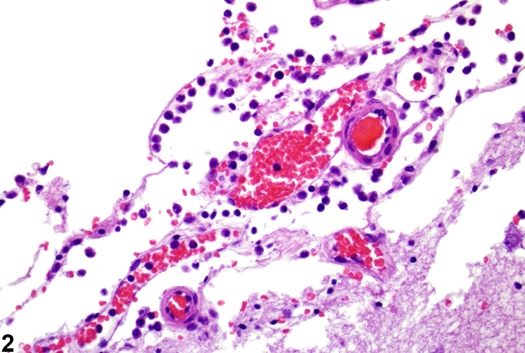 Image of inflammation in the brain from a female B6C3F1 mouse