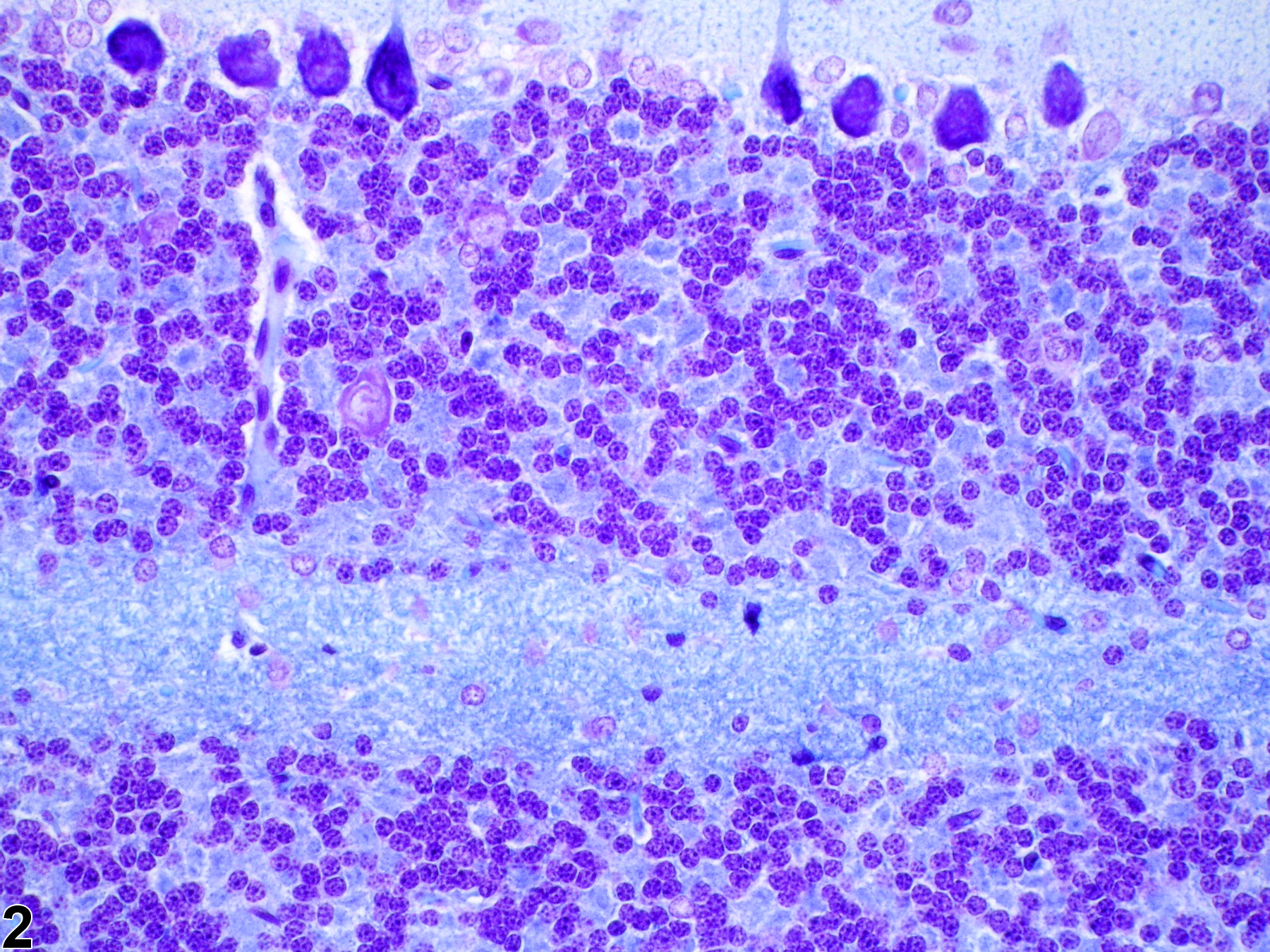 Image of intramyelinic edema in the brain from a  rat