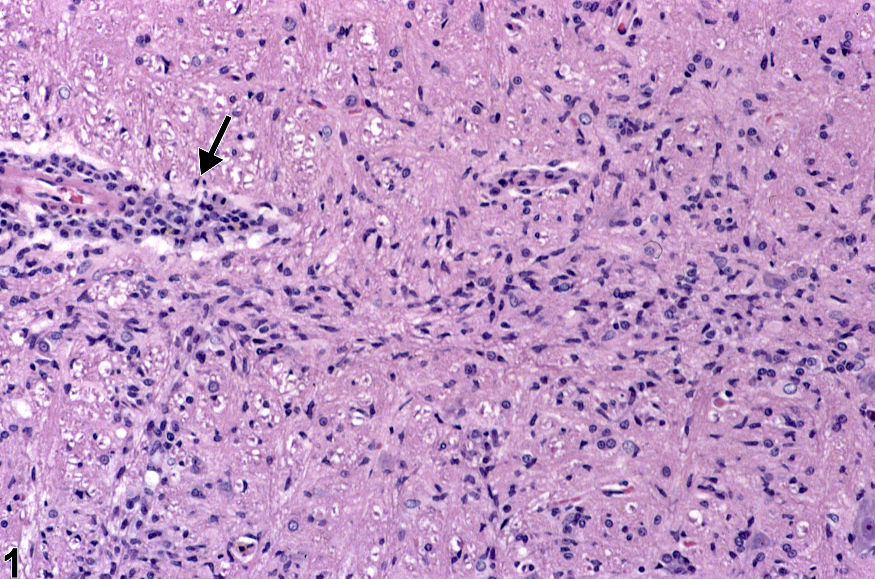 Image of microgliosis in the brain from a female F344/N rat in a chronic study