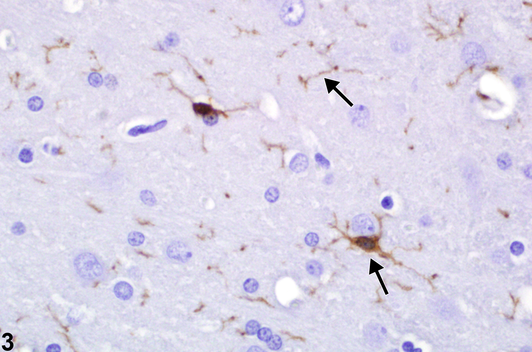 Image of microgliosis in the brain from an  F344/N rat