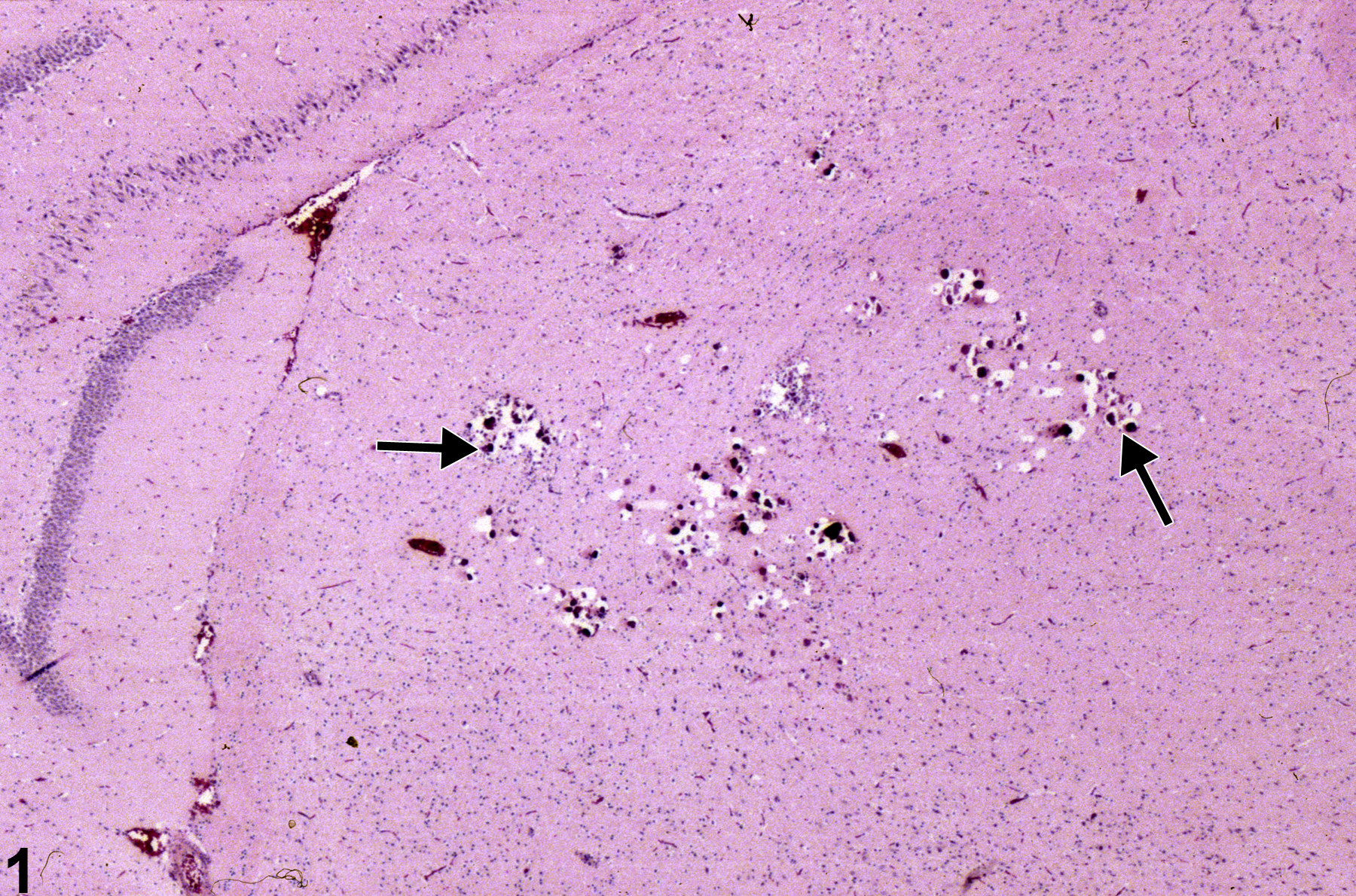 Image of mineralization in the brain from a female F344/N rat in a subchronic study