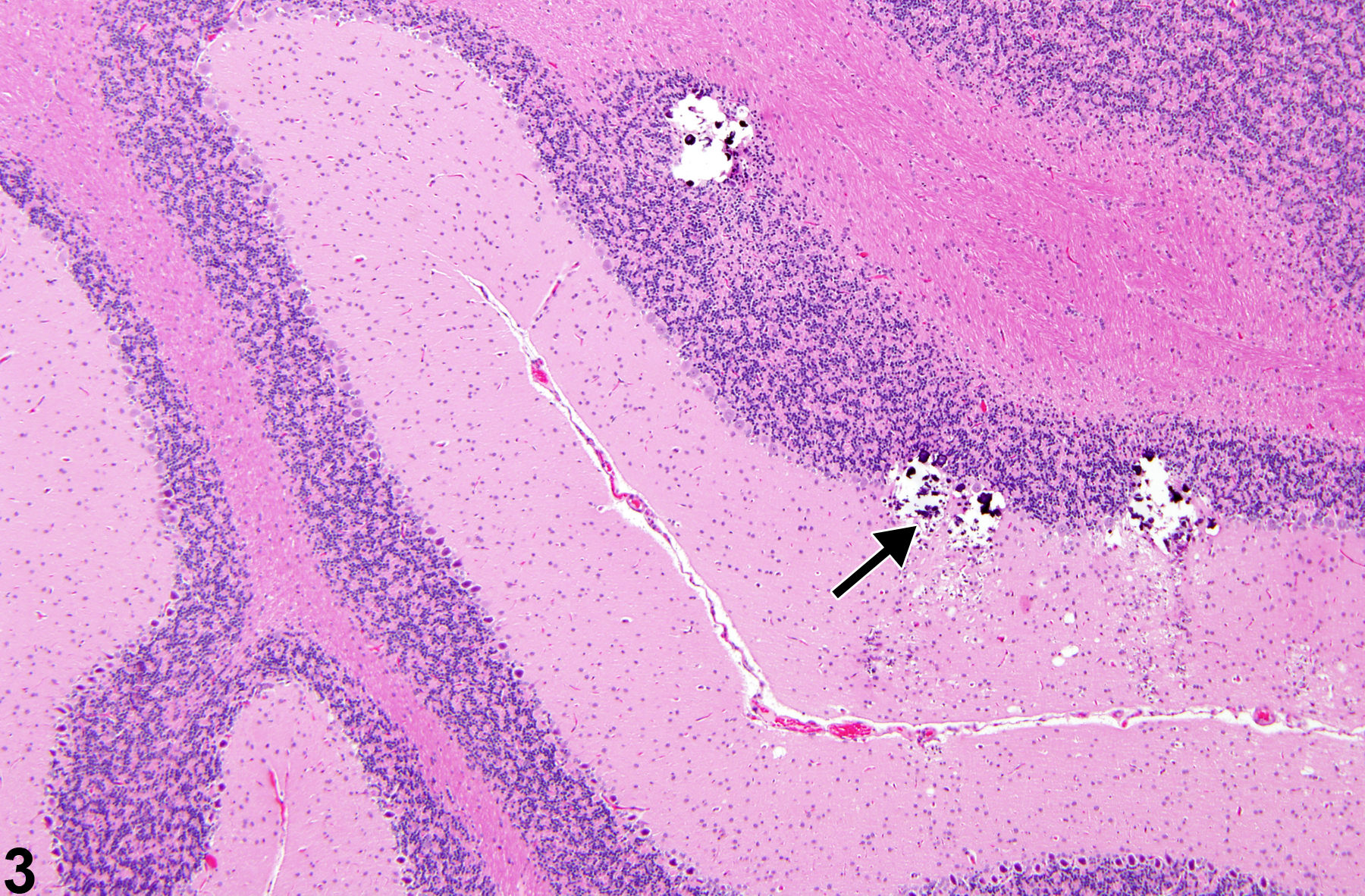Image of mineralization in the brain from a male F344/N rat in a subchronic study