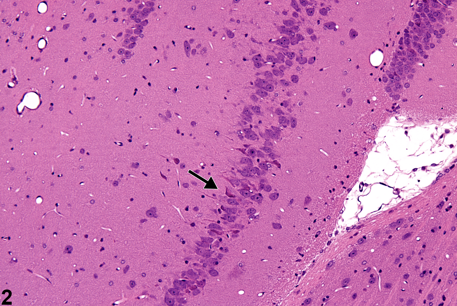 Image of Cell loss (normal comparison) in the Brain from a Male Not specified Rat in a Single dose  Study