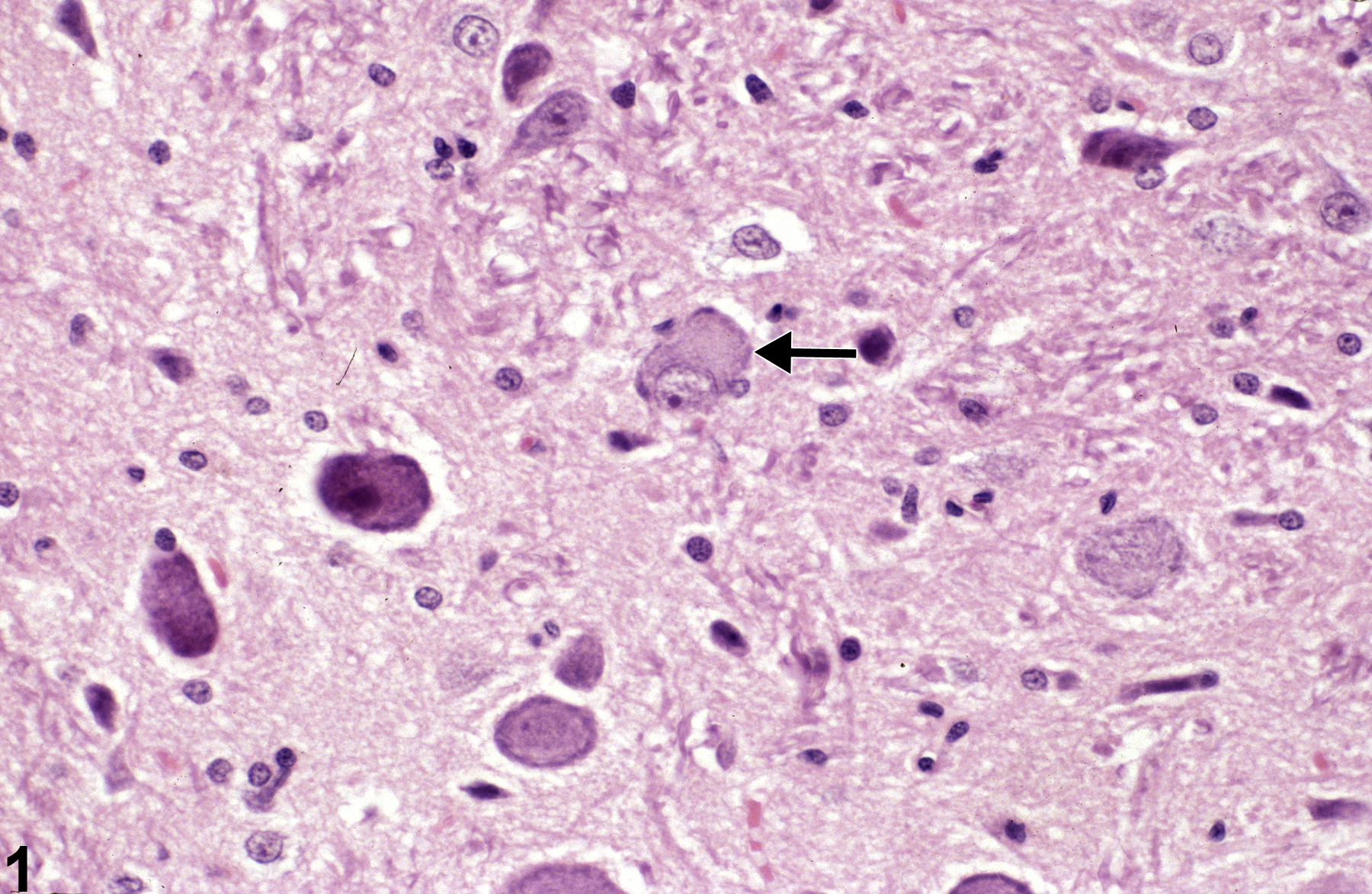 Image of Chromatolysis in the Brain from a Male F344/N Rat in a 90-day  Study
