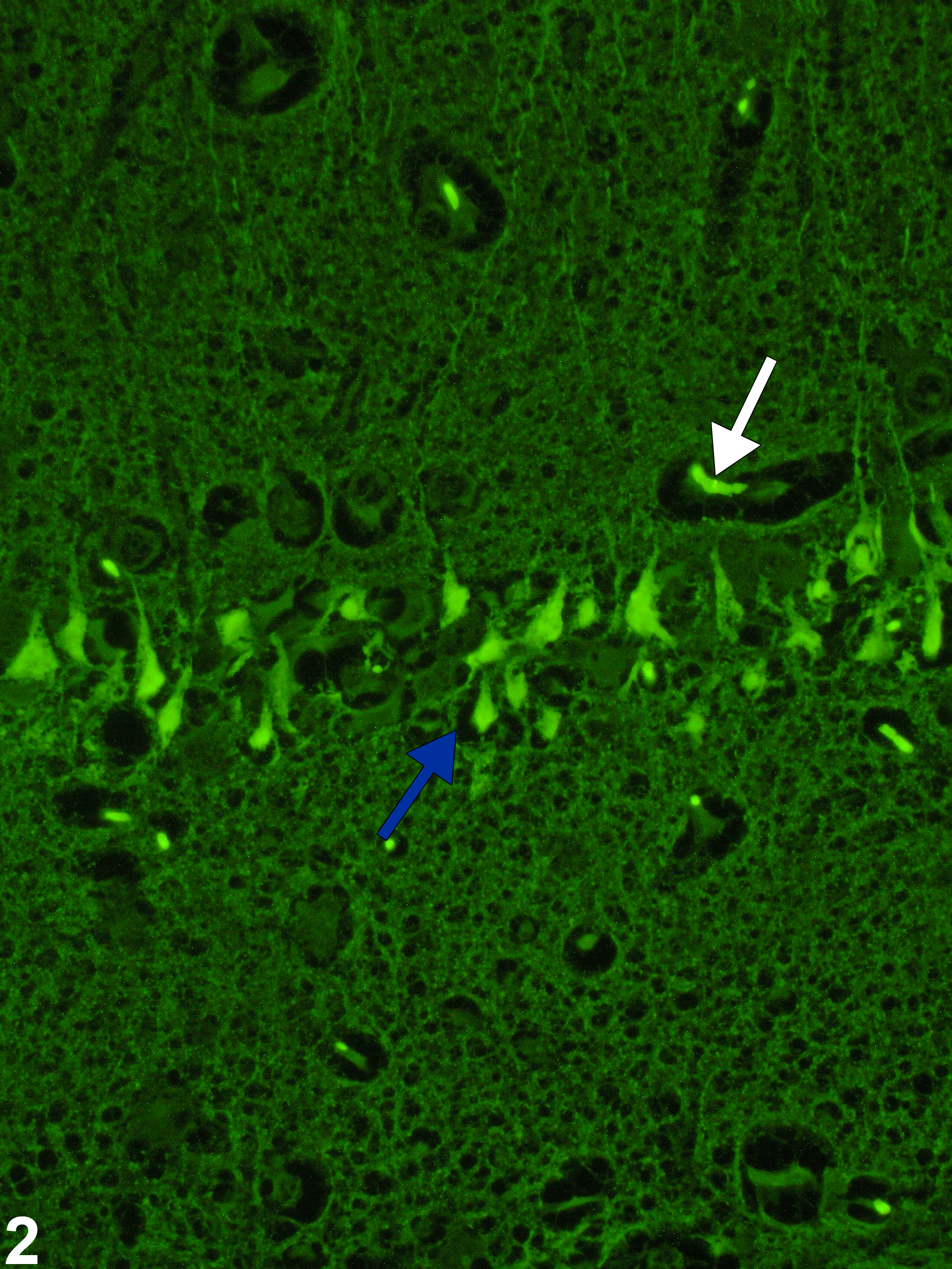 Image of necrosis in the brain from a Wistar rat in a subchronic study