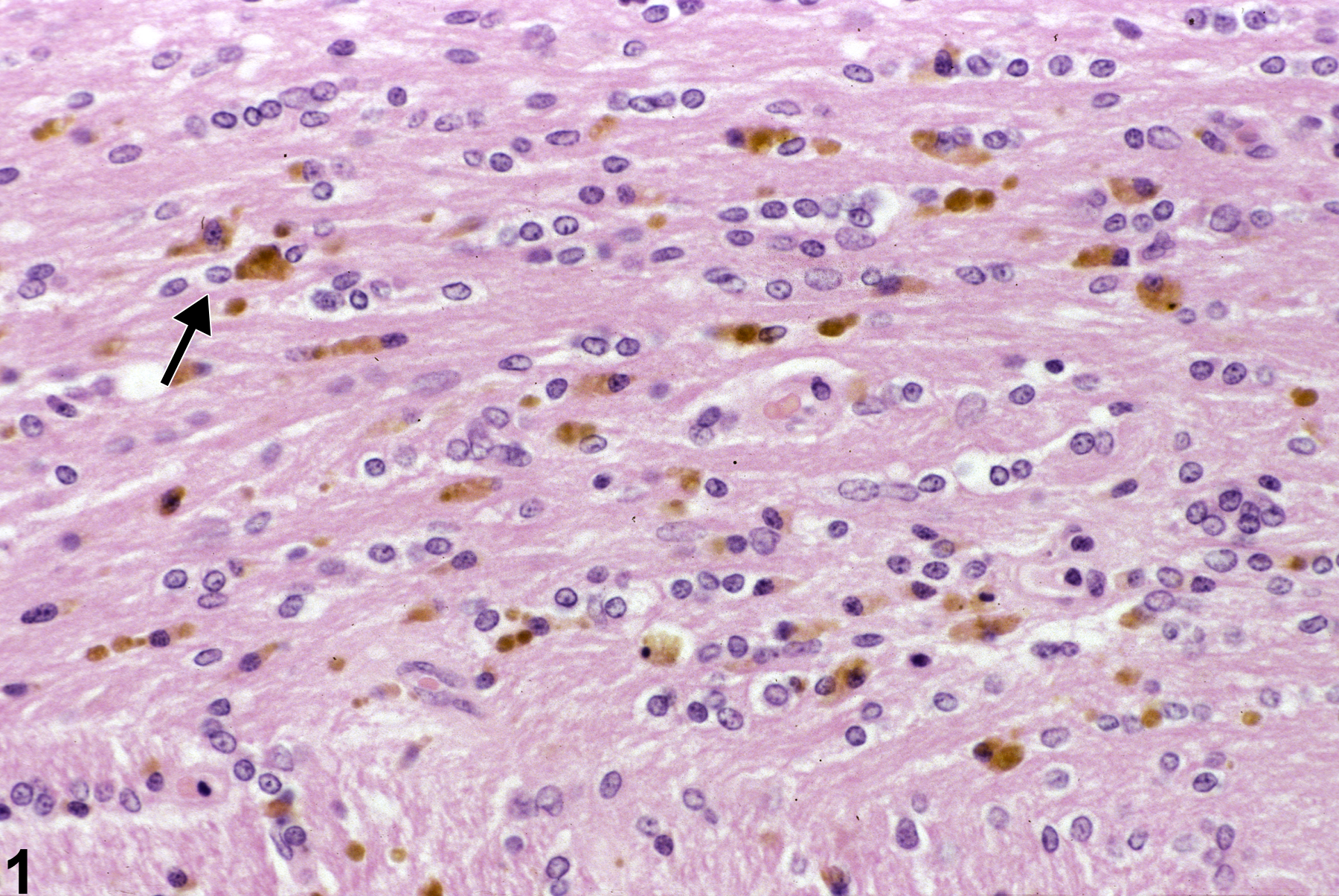 Image of pigment in the brain from a female F344/N rat in a chronic study