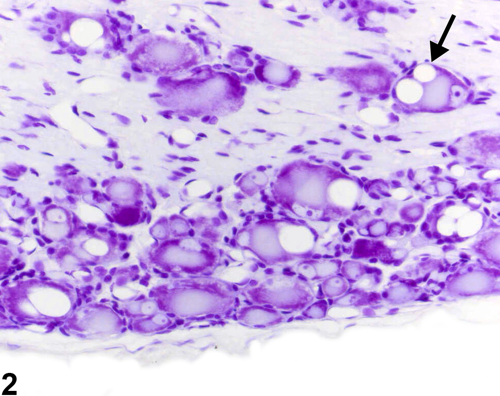 Image of Vacuolation in the Dorsal root ganglion from a Not specified Not specified Not specified in a Not specified  Study