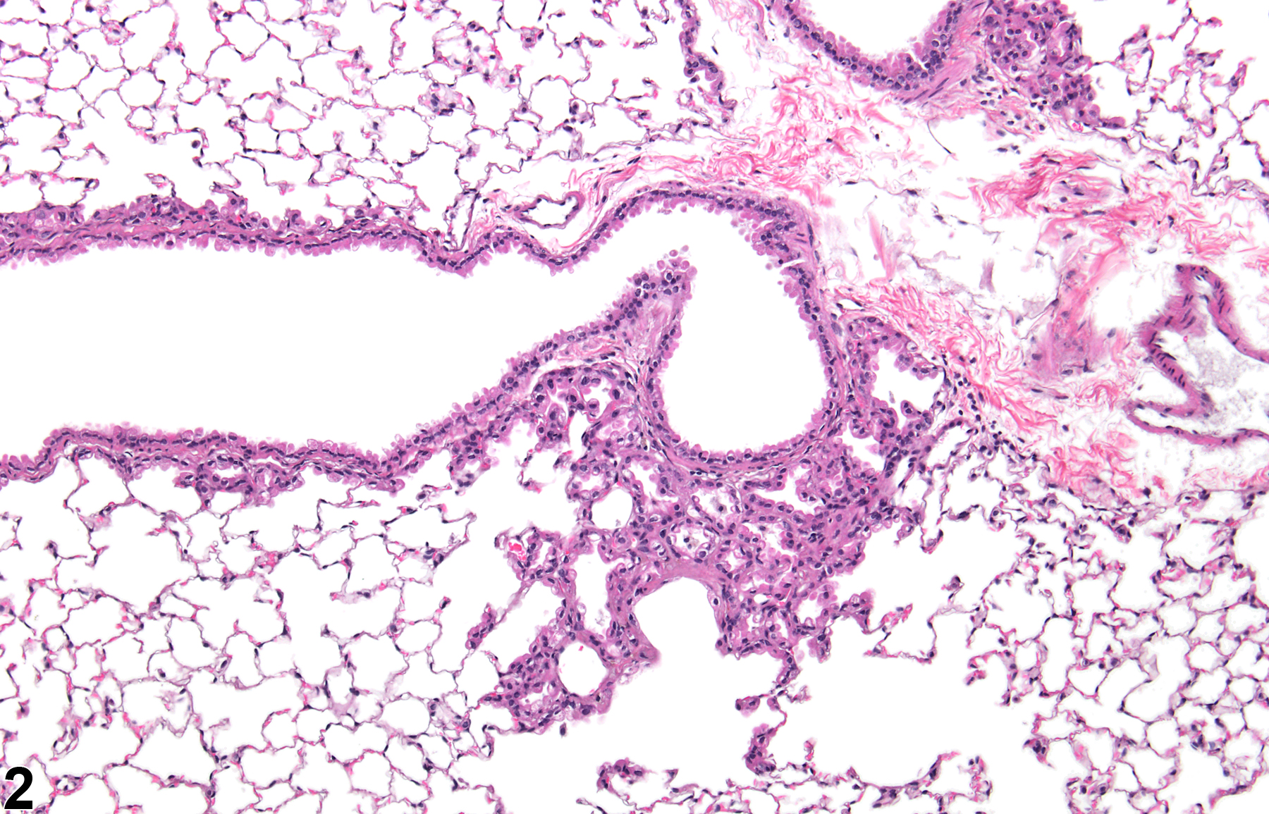 Image of alveolar/bronchiolar epithelial hyperplasia in the lung from a male B6C3F1/N mouse in a chronic study