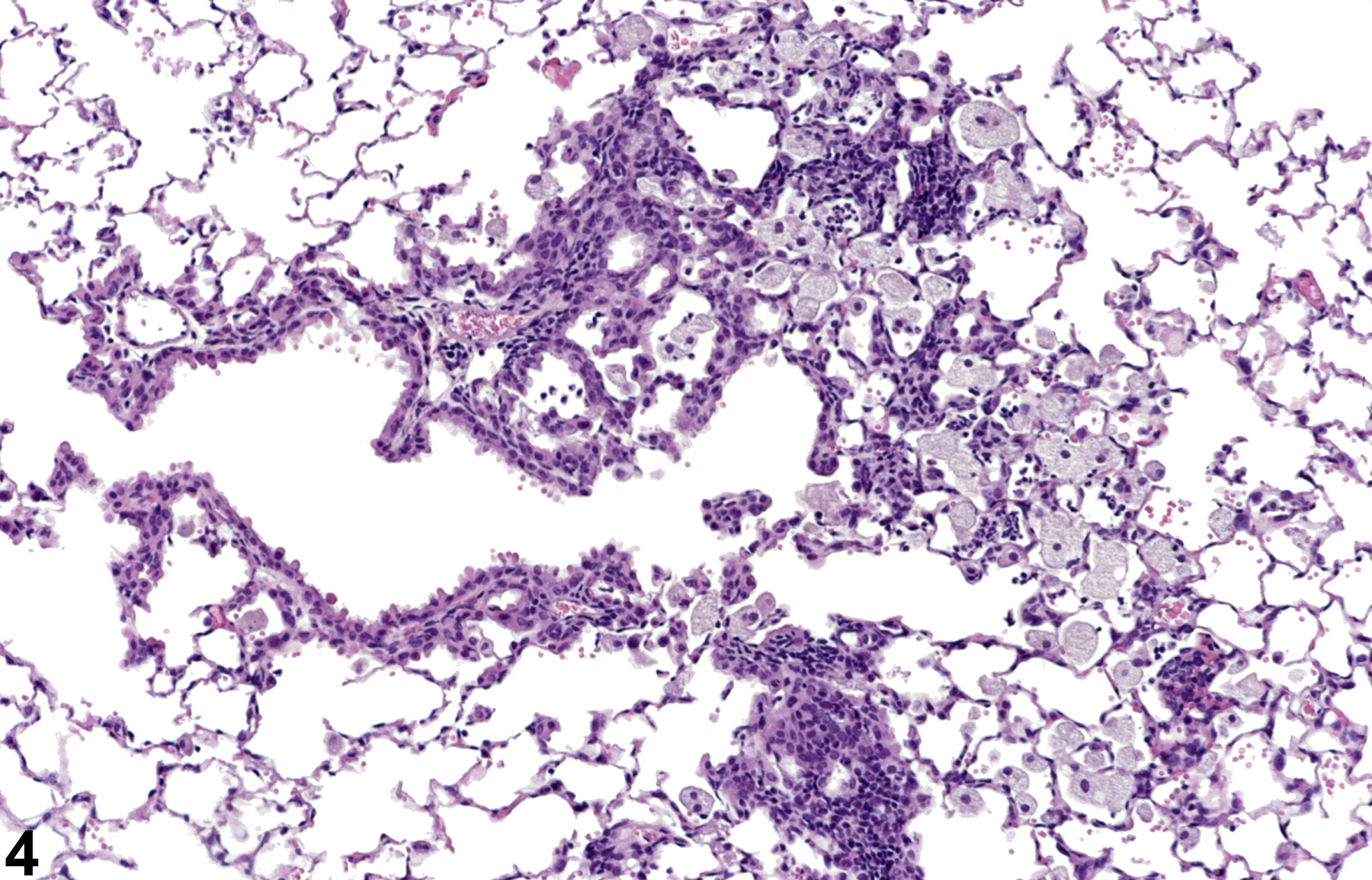 Image of alveolar/bronchiolar epithelial hyperplasia in the lung from a male B6C3F1/N mouse in a chronic study