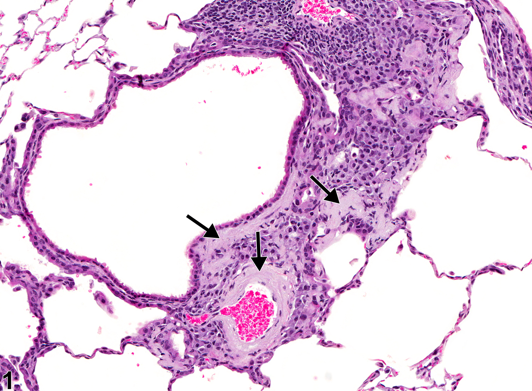 Image of amyloid in the lung from a female B6C3F1/N mouse in a chronic study