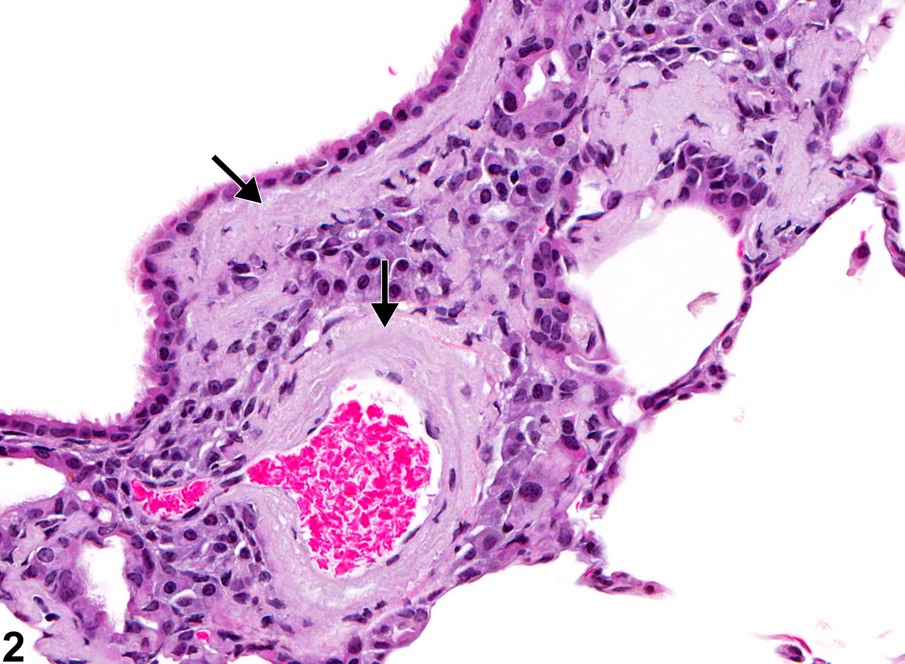 Image of amyloid in the lung from a female B6C3F1/N mouse in a chronic study