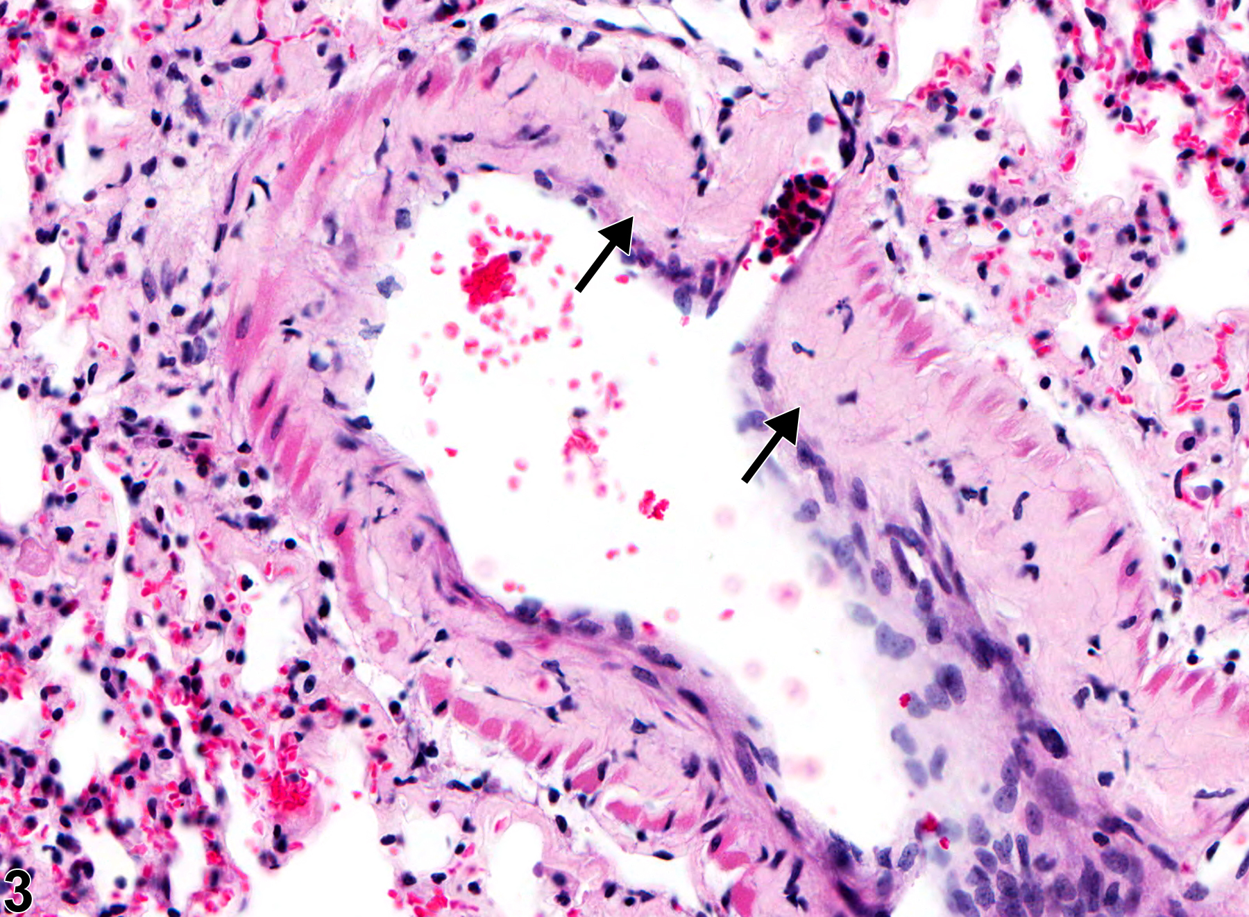 Image of amyloid in the lung from a male B6C3F1/N mouse in a chronic study