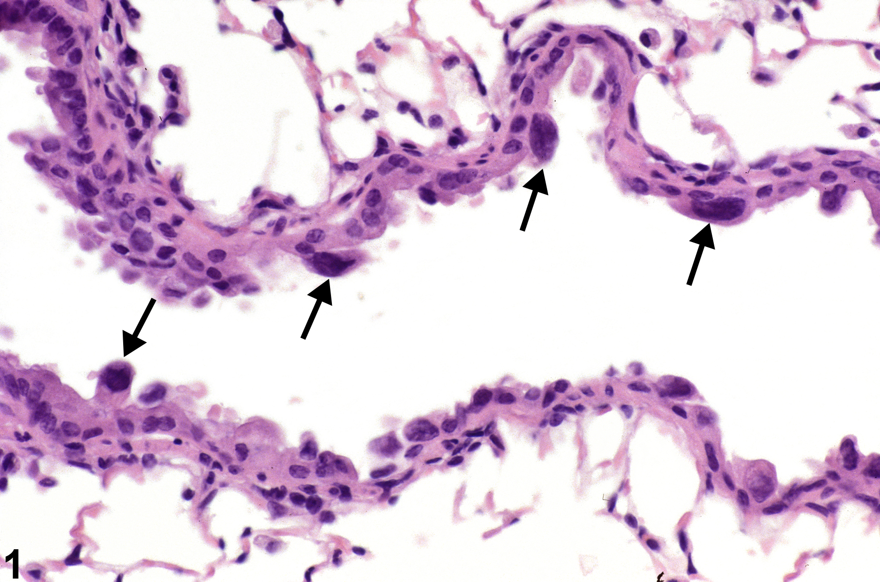 Image of atypia, cellular in the lung from a female B6C3F1/N mouse in a subchronic study