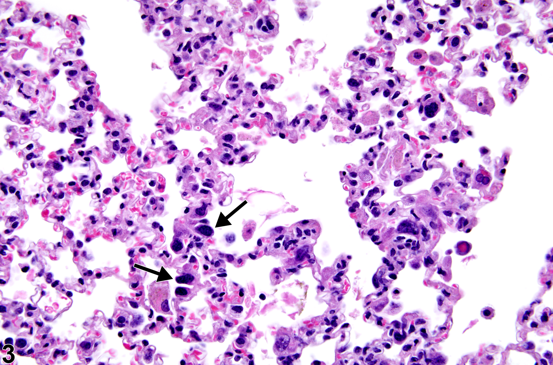 Image of atypia, cellular in the lung from a male B6C3F1/N mouse in a chronic study
