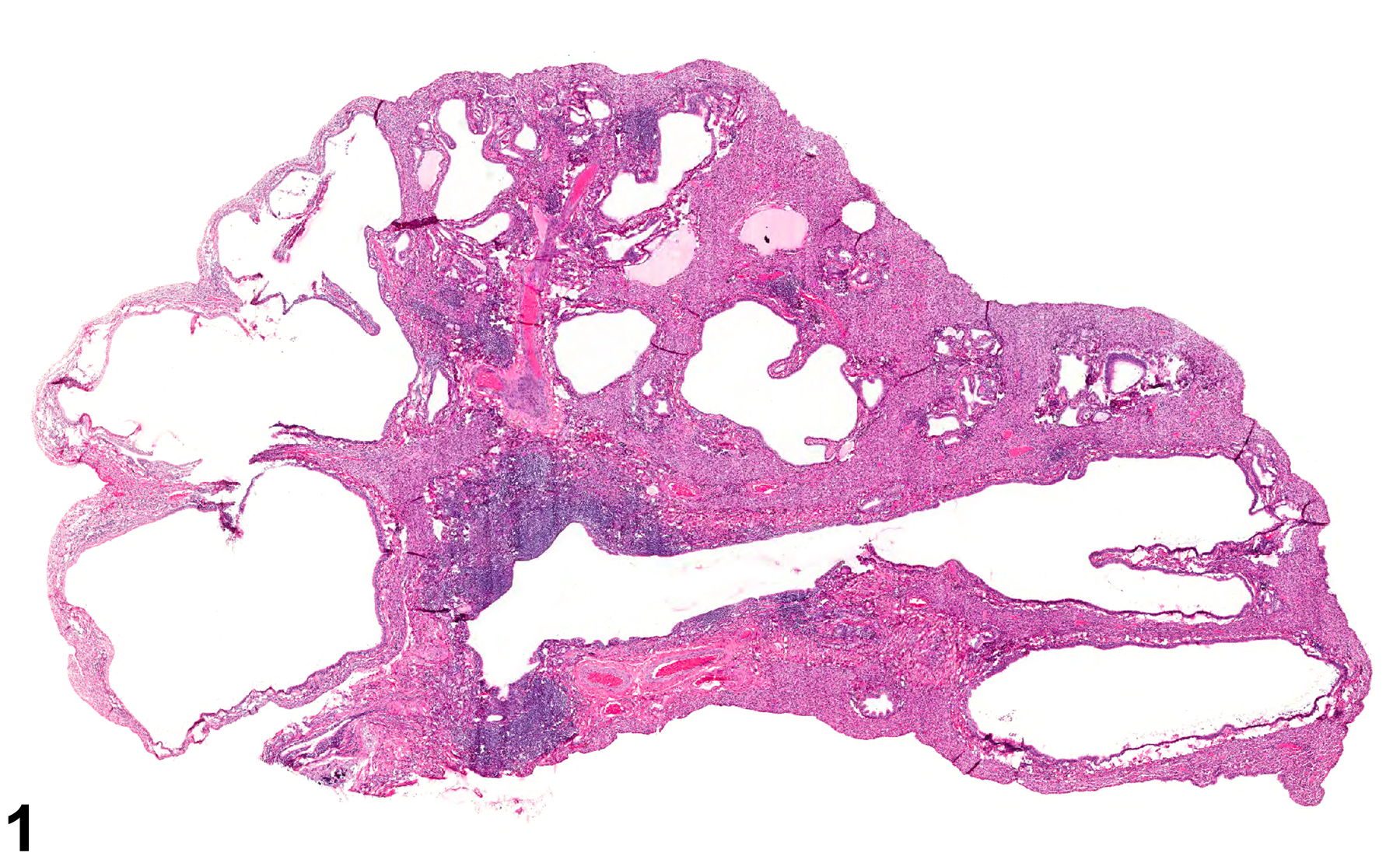 Image of bronchiectasis in the lung from a male F344/N rat in a chronic study