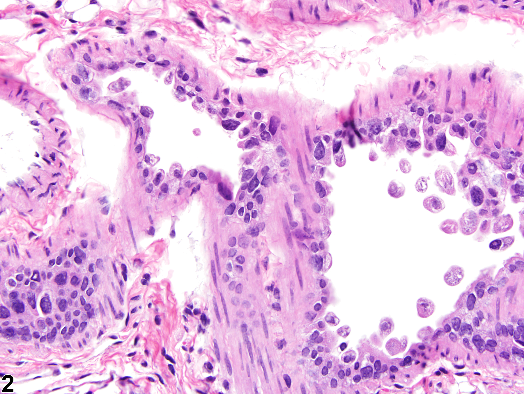 Image of epithelial degeneration in the lung from a male B6C3F1/N mouse in a subchronic study