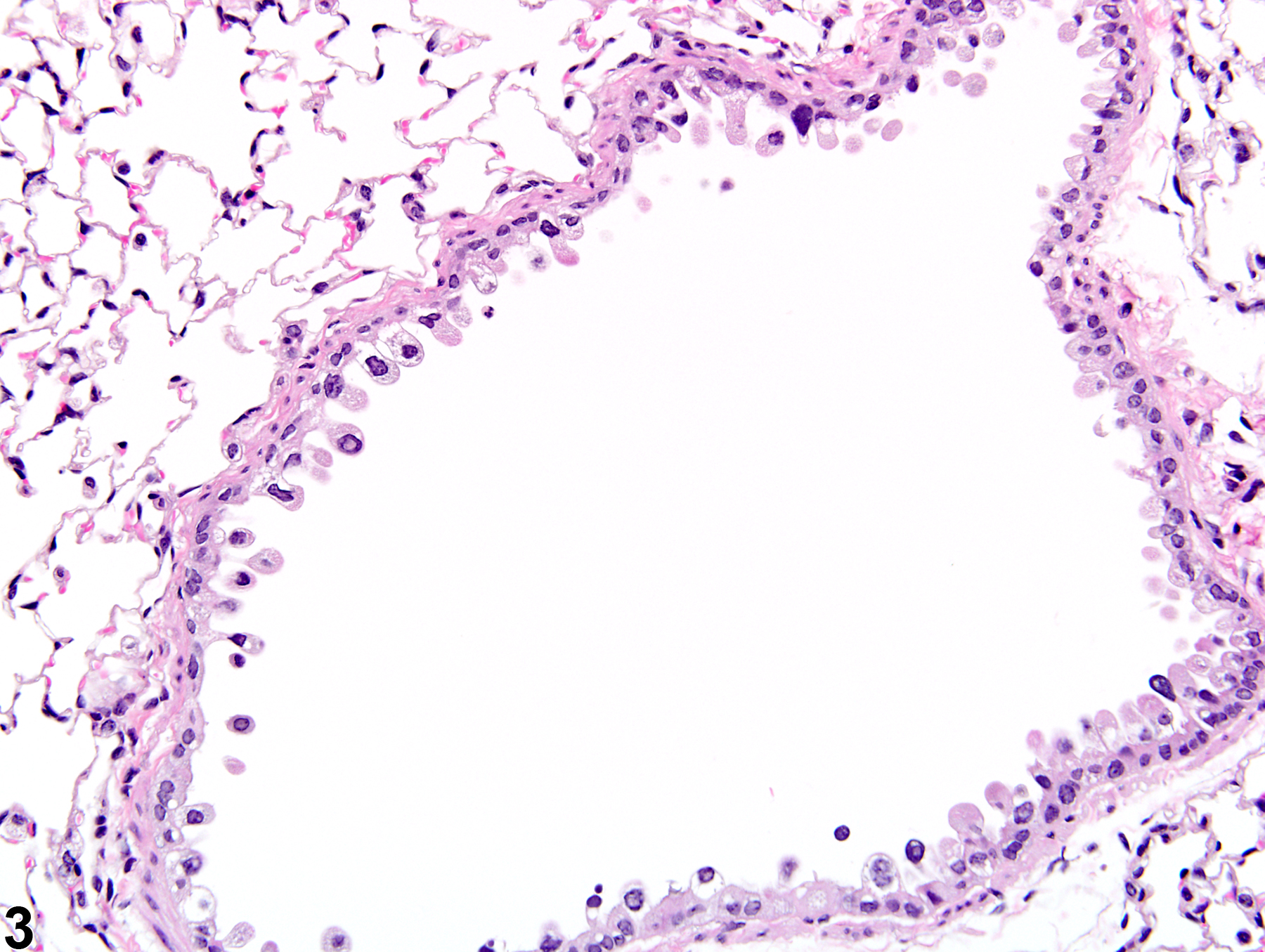 Image of epithelial degeneration in the lung from a male B6C3F1/N mouse in a subchronic study