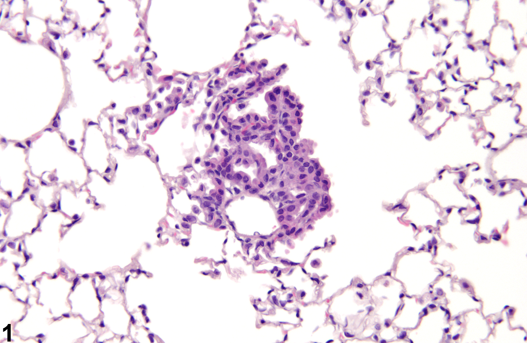 Image of alveolar epithelial hyperplasia in the lung from a male B6C3F1/N mouse in a chronic study