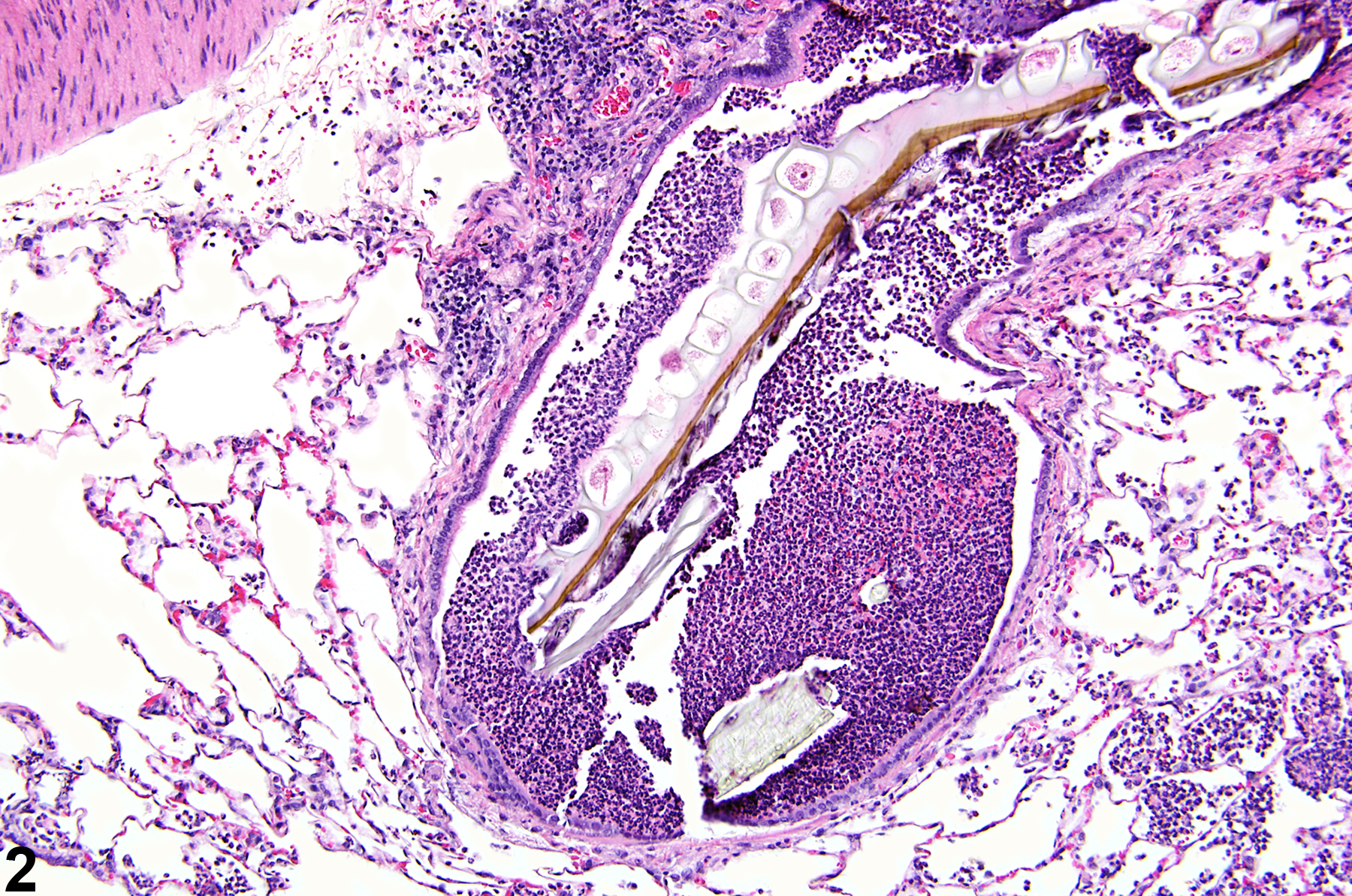 Image of foreign body in the lung from a male Harlan Sprague-Dawley rat in a chronic study