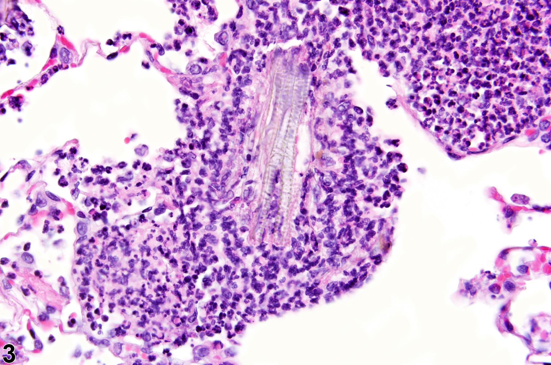 Image of foreign body in the lung from a male Harlan Sprague-Dawley rat in a chronic study