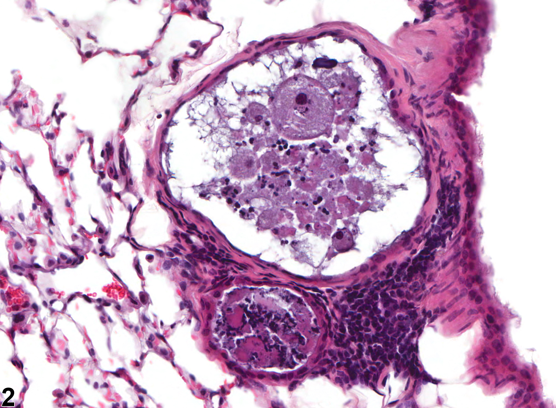 Image of glandular cyst in the lung from a male B6C3F1/N mouse in a chronic study