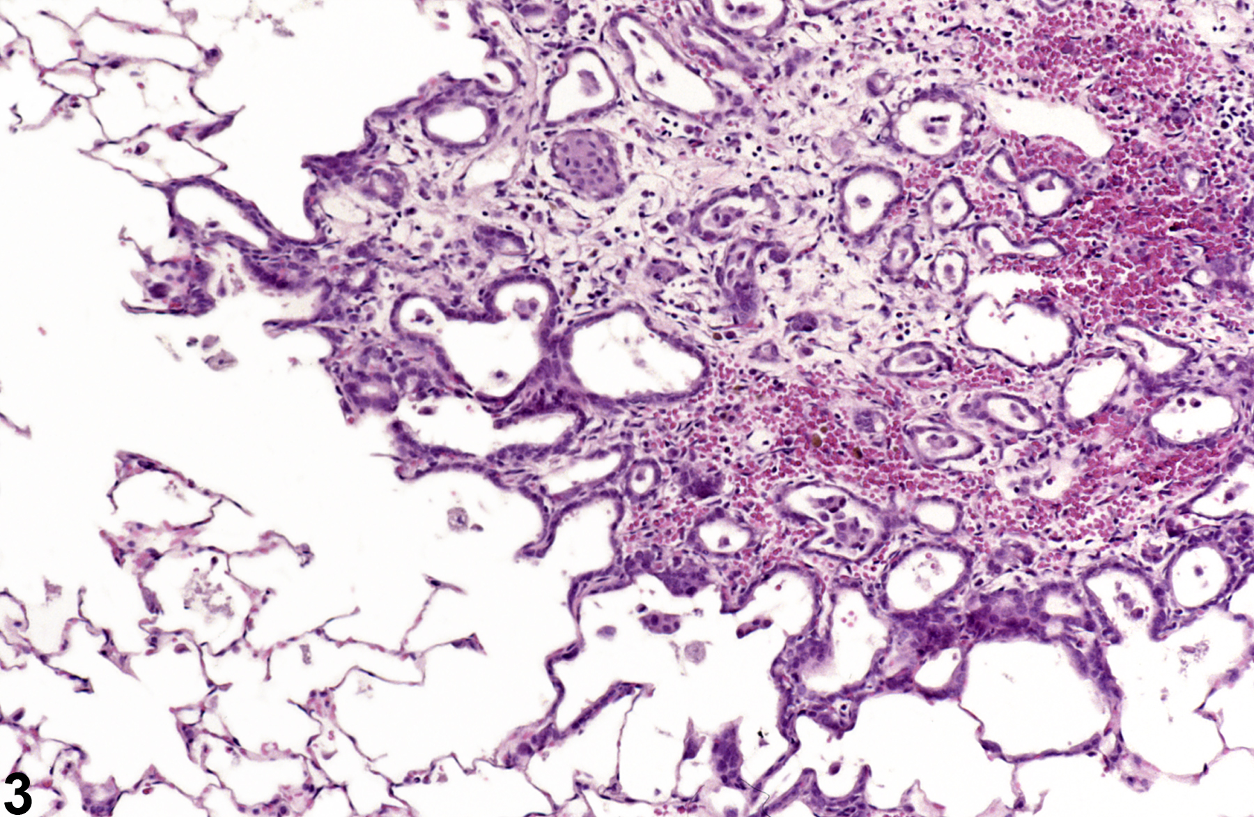 Image of hemorrhage in the lung from a male F344/N rat in a chronic study