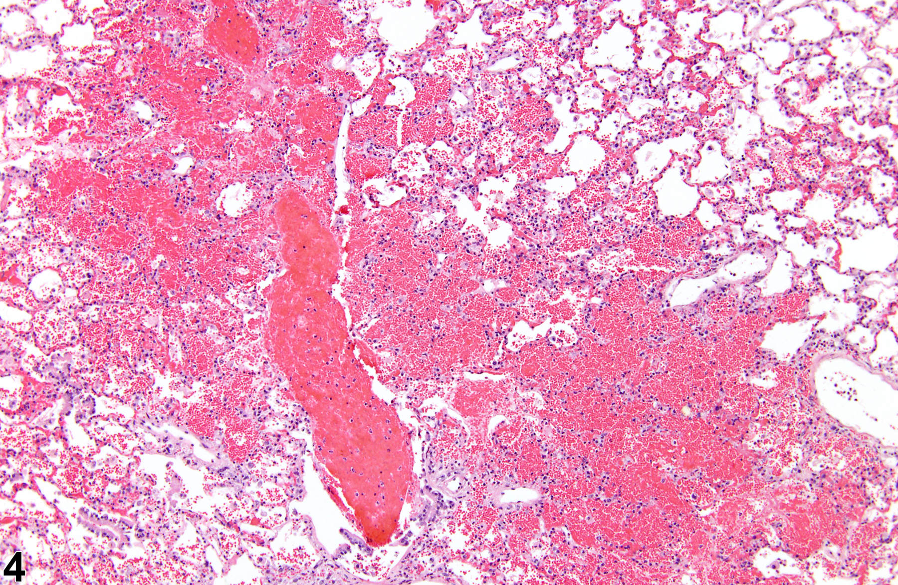 Image of hemorrhage in the lung from a male F344/N rat in a chronic study