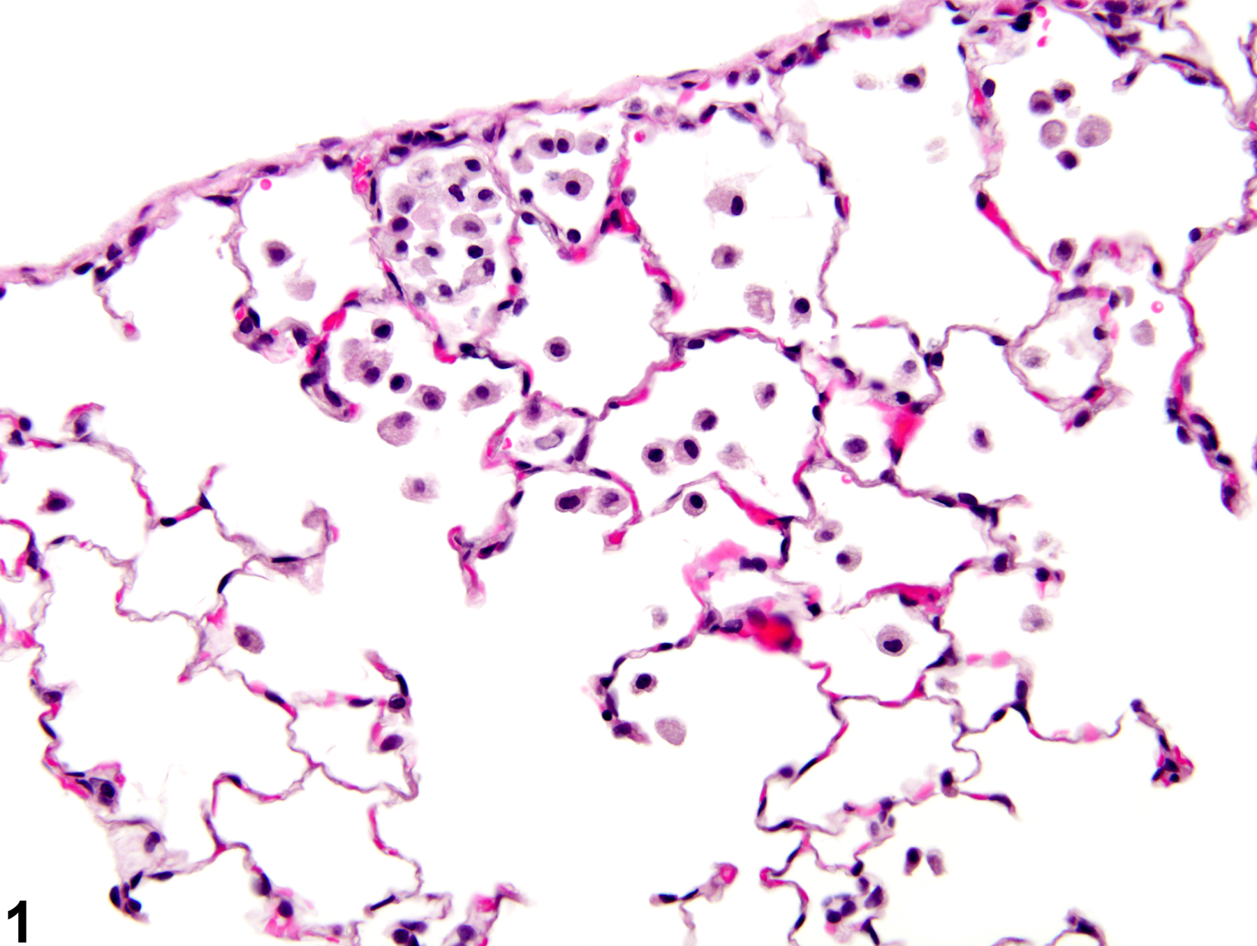 Image of infiltration cellular, histiocyte in the lung from a male Wistar Han rat in a subchronic study