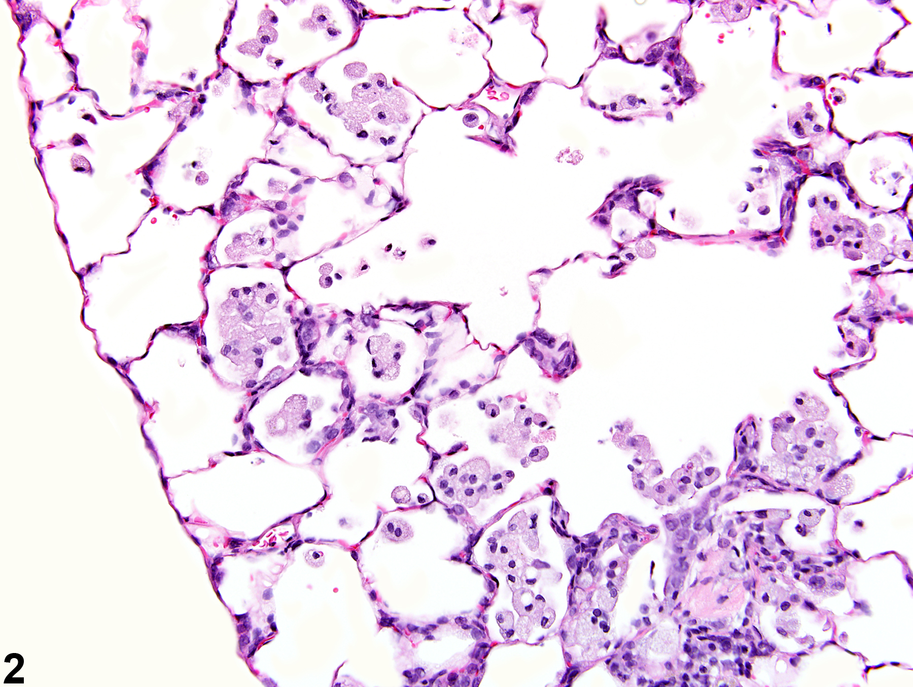 Image of infiltration cellular, histiocyte in the lung from a female Harlan Sprague-Dawley rat in a chronic study